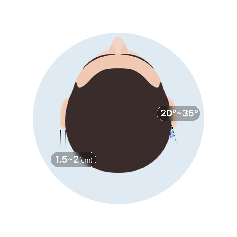 이상적인 귀 각도