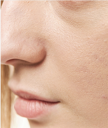 추천 타입 이미지 2